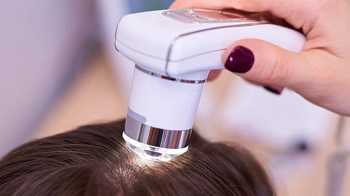 Micropigmentación capilar